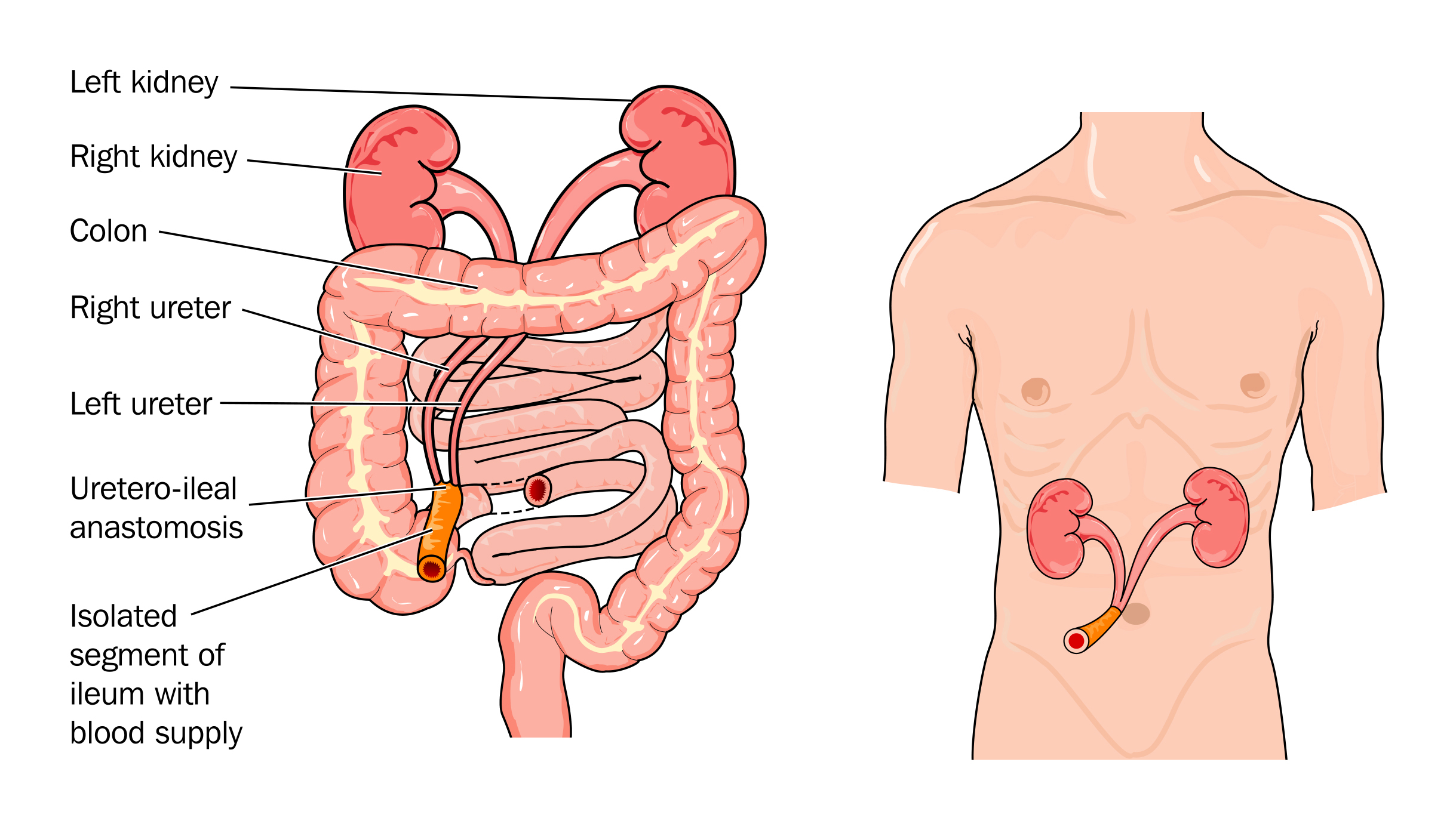 urology